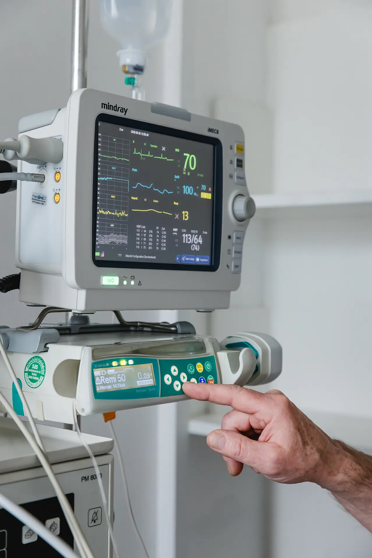 Anästhesie-Monitor zur Überwachung der Vitalwerte während einer Behandlung in Narkose